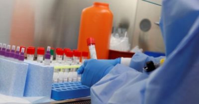 FDA Mỹ phê duyệt bộ xét nghiệm COVID-19 cho kết quả sau 5 phút