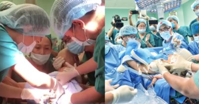 Video: Khoảnh khắc tách rời cơ thể Trúc Nhi – Diệu Nhi