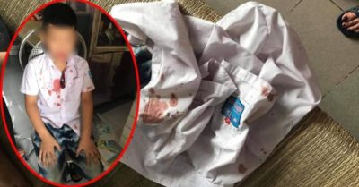 Phụ huynh hành hung bé trai lớp 1 chỉ vì đòi lại chiếc mũ cho con