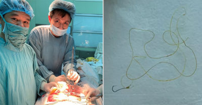 Hy hữu ăn cá, nuốt luôn cả lưỡi câu và đoạn dây cước vào bụng