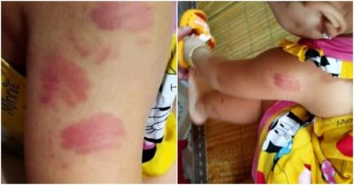 Hiệu trưởng lên tiếng vụ bé gái 21 tháng tuổi bầm tím người khi đến lớp