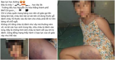Công an vào cuộc làm rõ vụ việc cô giáo đánh bầm tím đùi học sinh lớp 3