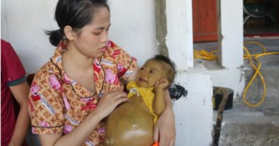 Giọt nước mắt của mẹ, sự bất lực của cha nhìn con gái 8 tháng tuổi mắc bệnh ‘lạ’, bụng to như cái trống