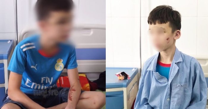Cậu bé 15 tuổi làm thuê: Có ngày em nhận 3 trận đòn, phải ăn bánh xèo thừa, ngủ đất