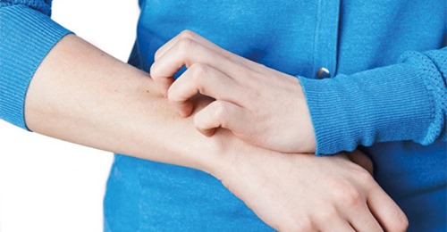 Dấu hiệu trên da cảnh báo nhiều loại ung thư