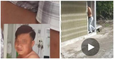 Thượng úy công an đi lấy ráy tai trong thời gian toàn tỉnh Cà Mau thực hiện Chỉ thị 16