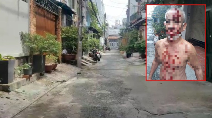 tiền trợ cấp