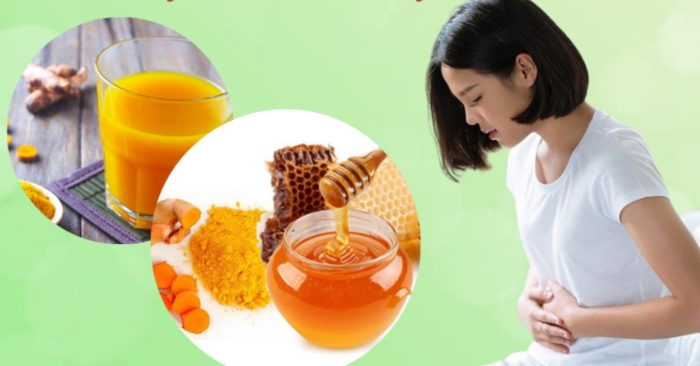 Uống bột nghệ mỗi ngày gây thủng dạ dày và sỏi thận