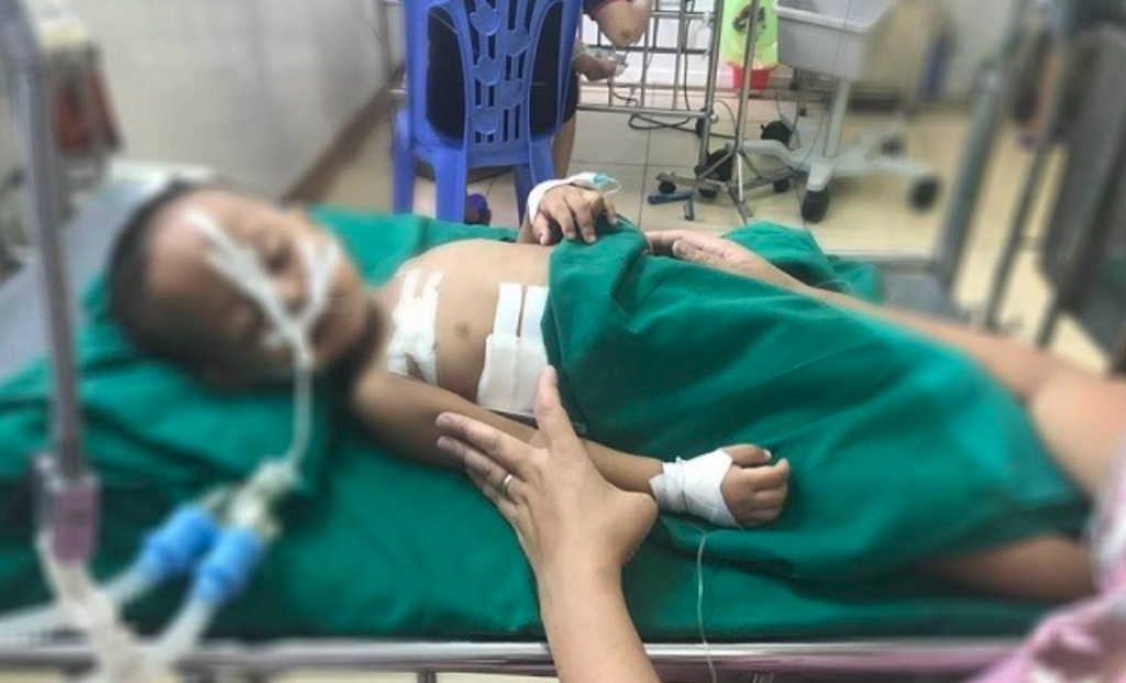 lạc đạn