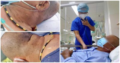 Đi thăm vườn, người đàn ông bị hàng trăm con ong đốt nguy kịch